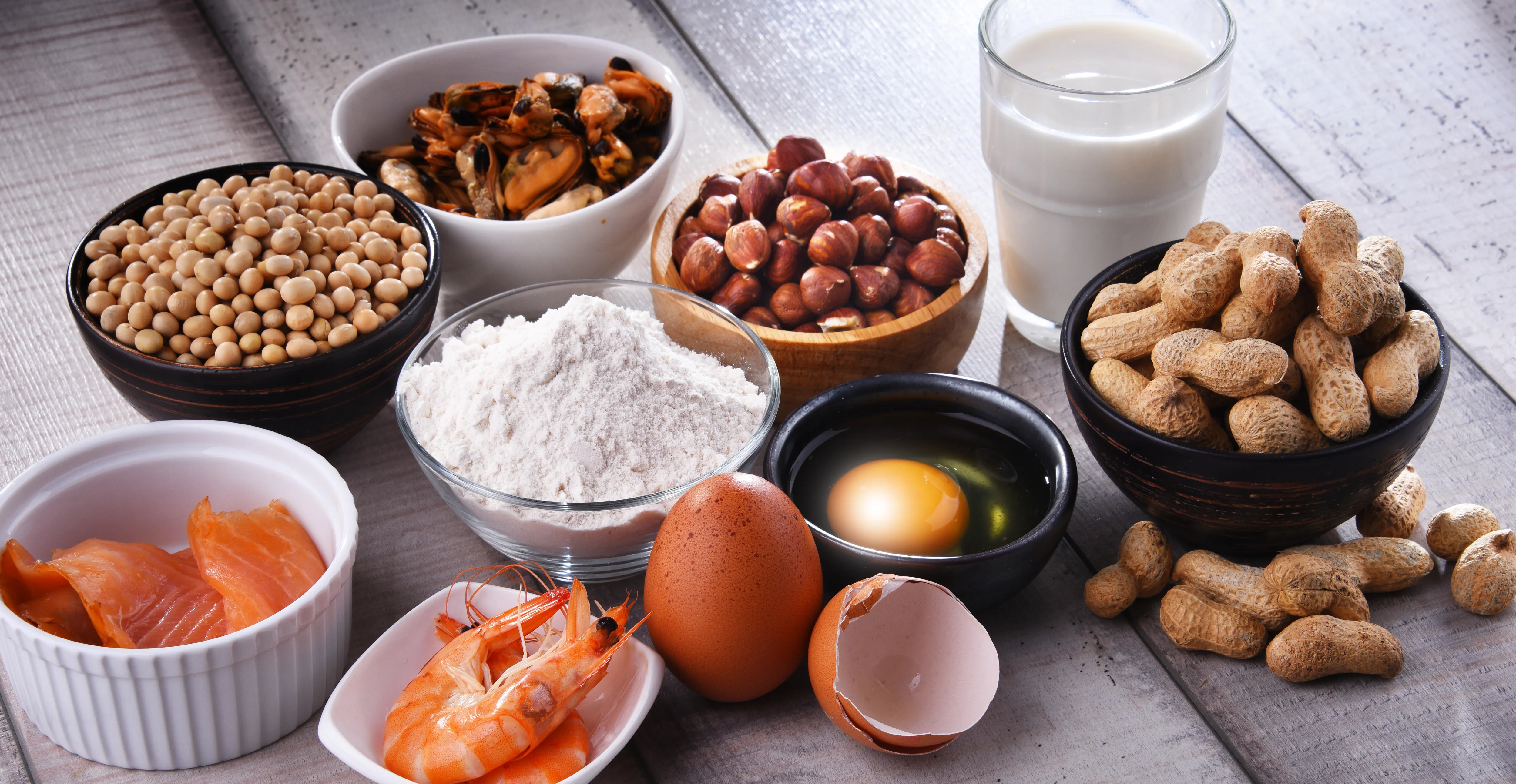 アレルギーの聞き方の注意点は？